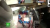 Петербургские нейрохирурги готовы первыми бороться с болезнью Паркинсона с помощью ультразвука