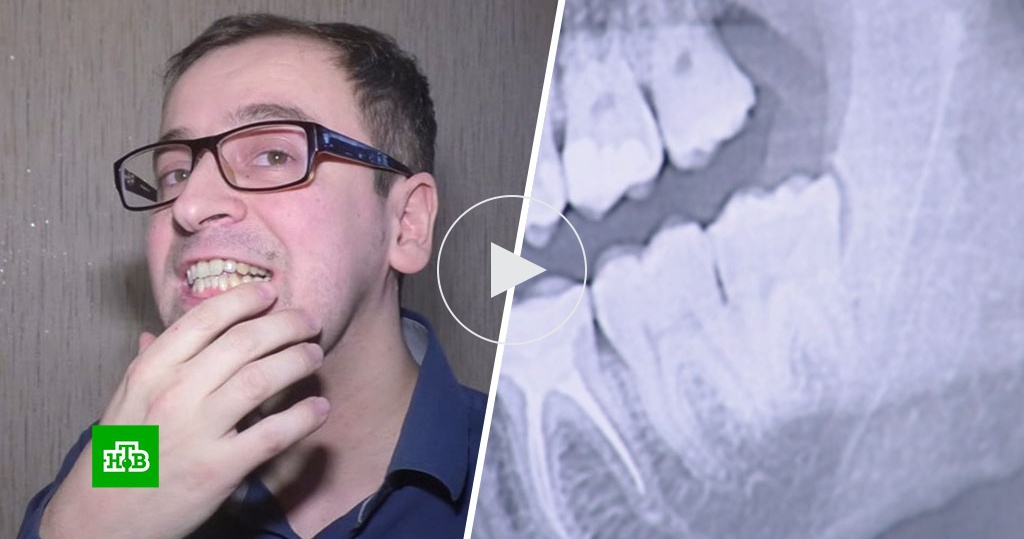 Ветеринар пытается отсудить у дантиста миллион рублей за сломанную ...