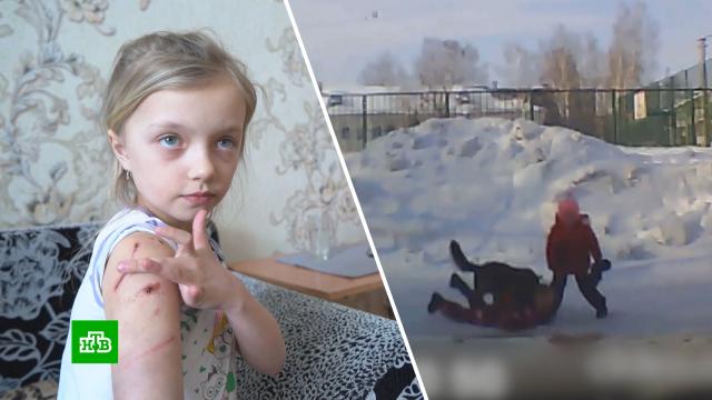 Стало известно о состоянии девочки, пострадавшей от собаки в Новосибирске.Новосибирск, дети и подростки, нападения, расследование, собаки.НТВ.Ru: новости, видео, программы телеканала НТВ