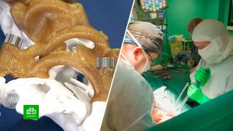 3D-технологии помогли детским травматологам из Петербурга исправлять дефекты позвоночника