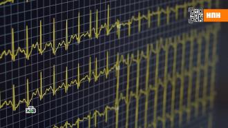 Кардиограммы недостаточно: как предотвратить серьезные проблемы с сердцем