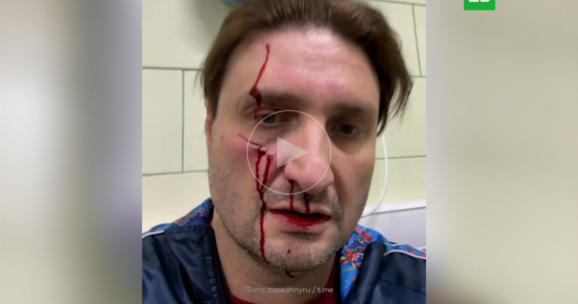 Тигр ранил в лицо Эдгарда Запашного // Новости НТВ