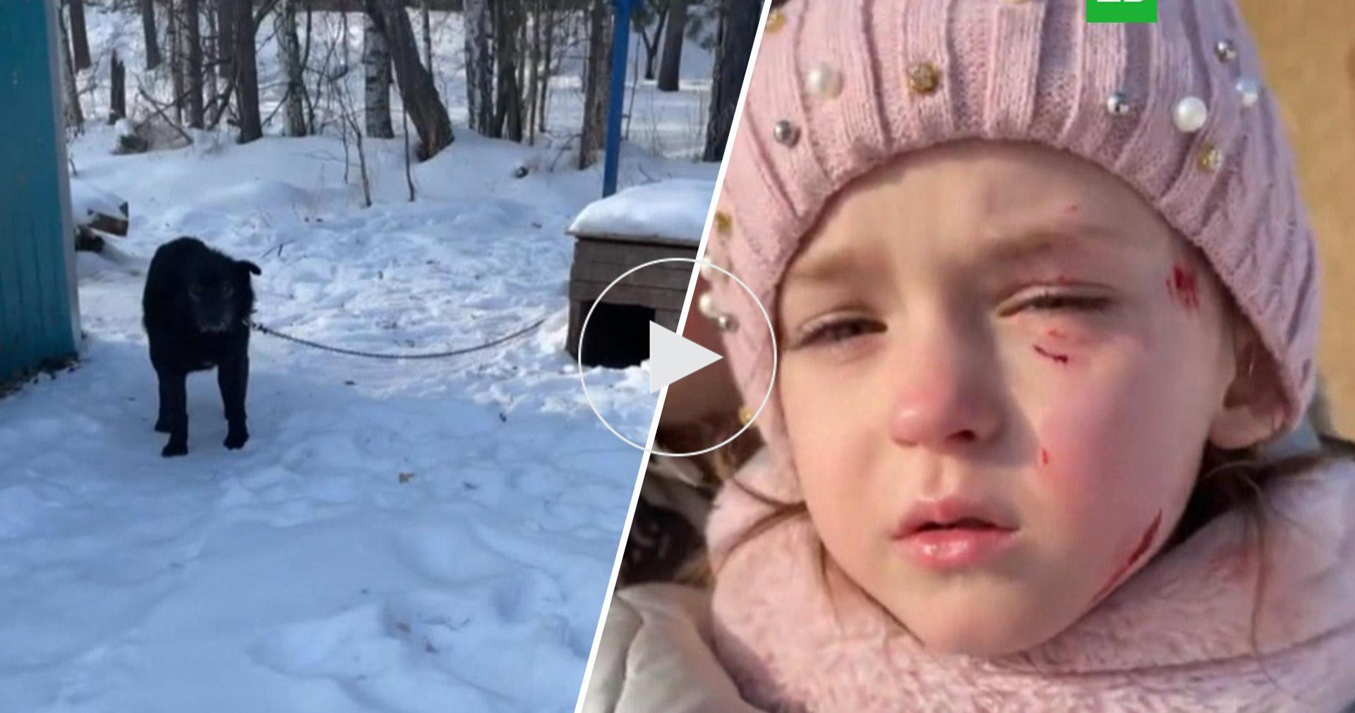 Сторожевой пес искусал ребенка в питомнике в Екатеринбурге // Новости НТВ