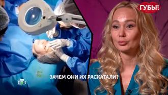 У россиянки лопнула губа после операции у косметолога из соцсетей