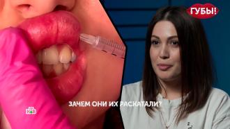 Жизнь превратилась в ад: косметолог накачал губы девушки вазелином