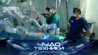 Выпуск от 9 октября 2022 года.Невероятные роботы-врачи, «воздушный» пластилин и все о пользе телевизора для детей.НТВ.Ru: новости, видео, программы телеканала НТВ